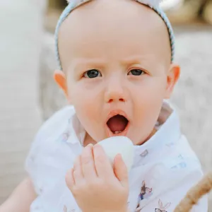 Cleft lip patient at AdventHealth for Children