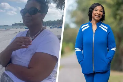 Bariatric patient Katrina's before and after photos.