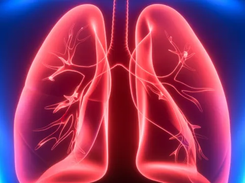 Model of lungs in 3d for lung nodule clinic