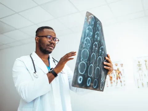 Brain scans