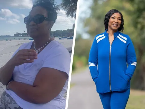 Bariatric patient Katrina's before and after photos.