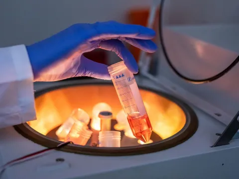 A Lab Sample is Bring Loaded into a Centrifuge