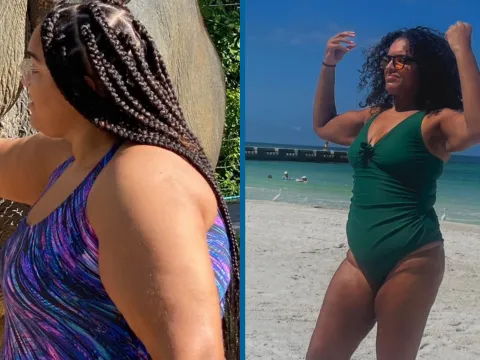 Sharlene Before and After 