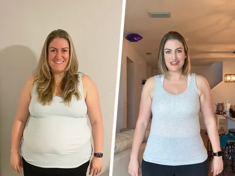 Stephanie Before and After Bariatrics