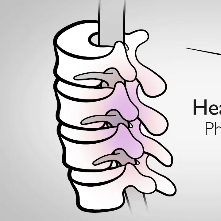 Pain Management Injections
