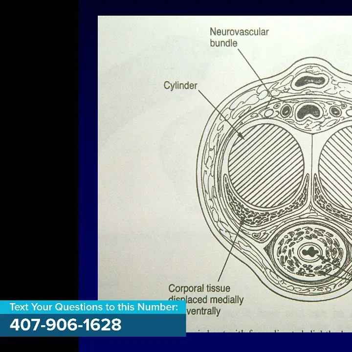 Urologic Abnormalities and Treatment Options for Complex Urologic Conditions