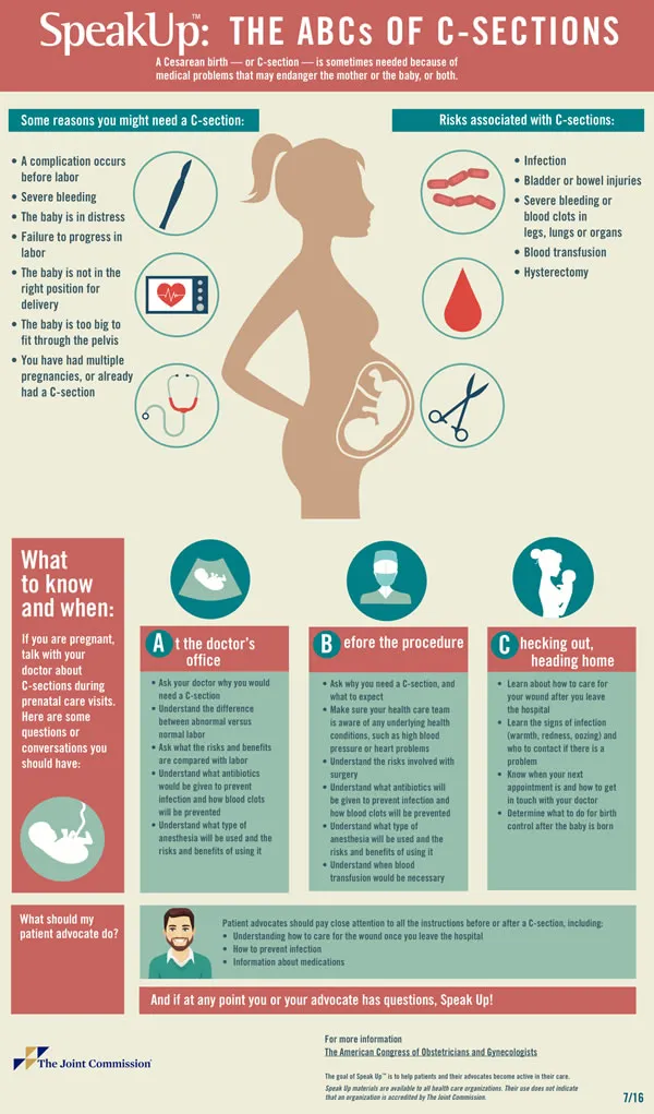 Speak Up™: ABC’s of C-Sections